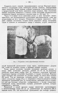  Бюллетень Арктического института СССР. № 8-9.-Л., 1936, с.381-383 посол оленины - 0002.jpg